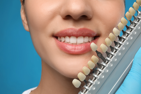 Caring For Your Dental Veneers: Tips For Long Lasting Results